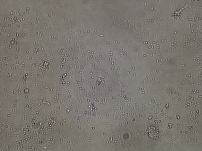 microbes microscopy pic by Jana Tischer